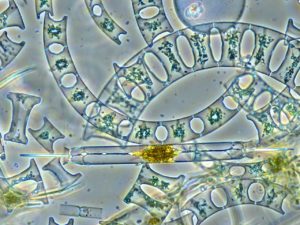 micrograph of phytoplankton